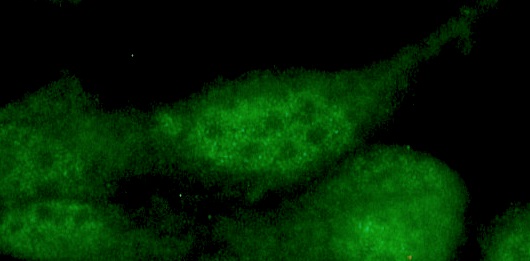 Figure 2: Immunoreactivity of X1415M, the mouse anti human myogenin in nuclei of formaldehyde fixed C2C12 mouse muscle myoblast cells in culture (high magnification).
